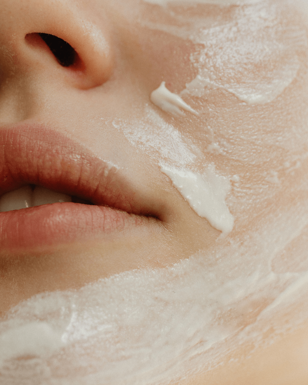 Unreine Haut - H3R LAB